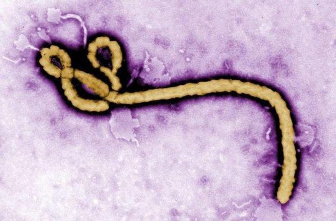 El Virus Ebola